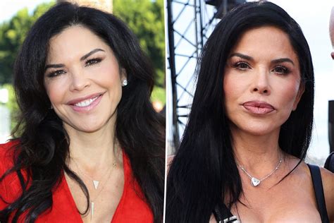 lauren sanchez surgery|Lauren Sanchez Before and After Plastic Surgery